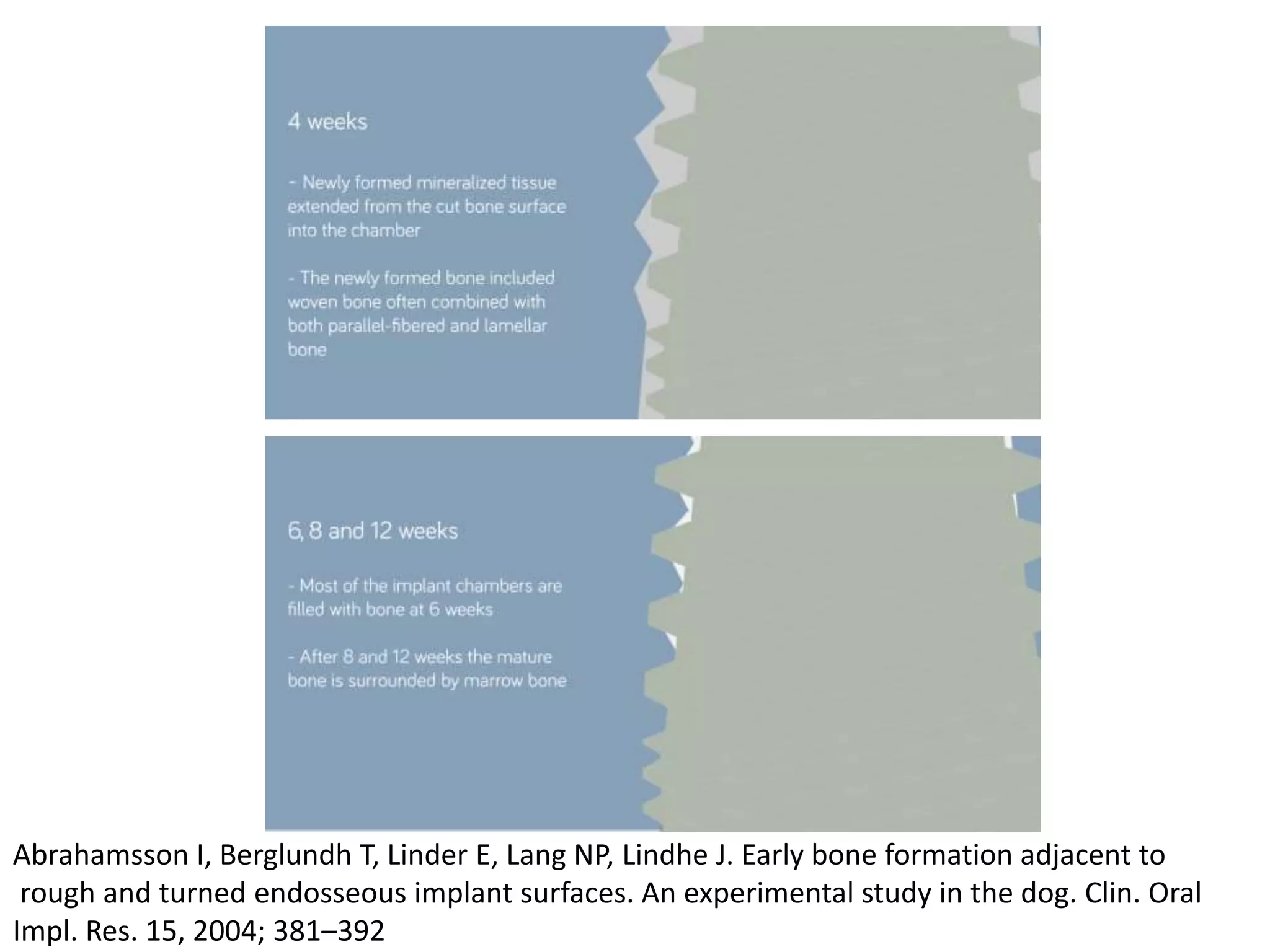 Abrahamsson I, Berglundh T, Linder E, Lang NP, Lindhe J. Early bone formation adjacent to
rough and turned endosseous implant surfaces. An experimental study in the dog. Clin. Oral
Impl. Res. 15, 2004; 381–392
 