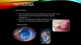 PATOGENIA
 Varios Procesos:
 1ero: Por presencia de gusanos adultos que dan origen a una
reaccion fibrosa que los encapsula formando nodulos
subcutaneos
 2do: Por microfiliarias que migran a linfaticos cutaneos y
reaciocion inmune que causa lesiones severas
Hipereosinofilia
 
