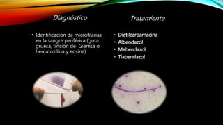 Diagnóstico
• Identificación de microfilarias
en la sangre periférica (gota
gruesa, tincion de Giemsa o
hematoxilina y eosina)
Tratamiento
• Dietilcarbamacina
• Albendazol
• Mebendazol
• Tiabendazol