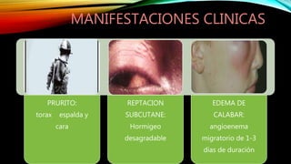 MANIFESTACIONES CLINICAS
PRURITO:
torax espalda y
cara
REPTACION
SUBCUTANE:
Hormigeo
desagradable
EDEMA DE
CALABAR:
angioenema
migratorio de 1-3
días de duración
 