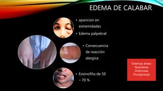EDEMA DE CALABAR
• aparicion en
extremidades
• Edema palpebral
• Consecuencia
de reacción
alergica
• Eosinofilia de 50
– 70 %
Extensas áreas:
Nodulares
Dolorosas
Pruriginosas
 