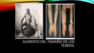 AUMENTO DEL TAMAÑO DE LOS
TEJIDOS.
 