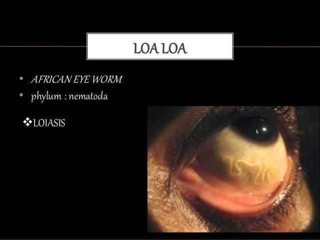 Loa loa parasitology