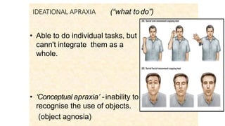 IDEATIONAL APRAXIA (“what todo”)
• Able to do individual tasks, but
cann't integrate them as a
whole.
• ‘Conceptual apraxia’ - inability to
recognise the use of objects.
(object agnosia)
 