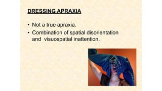 DRESSING APRAXIA
• Not a true apraxia.
• Combination of spatial disorientation
and visuospatial inattention.
 