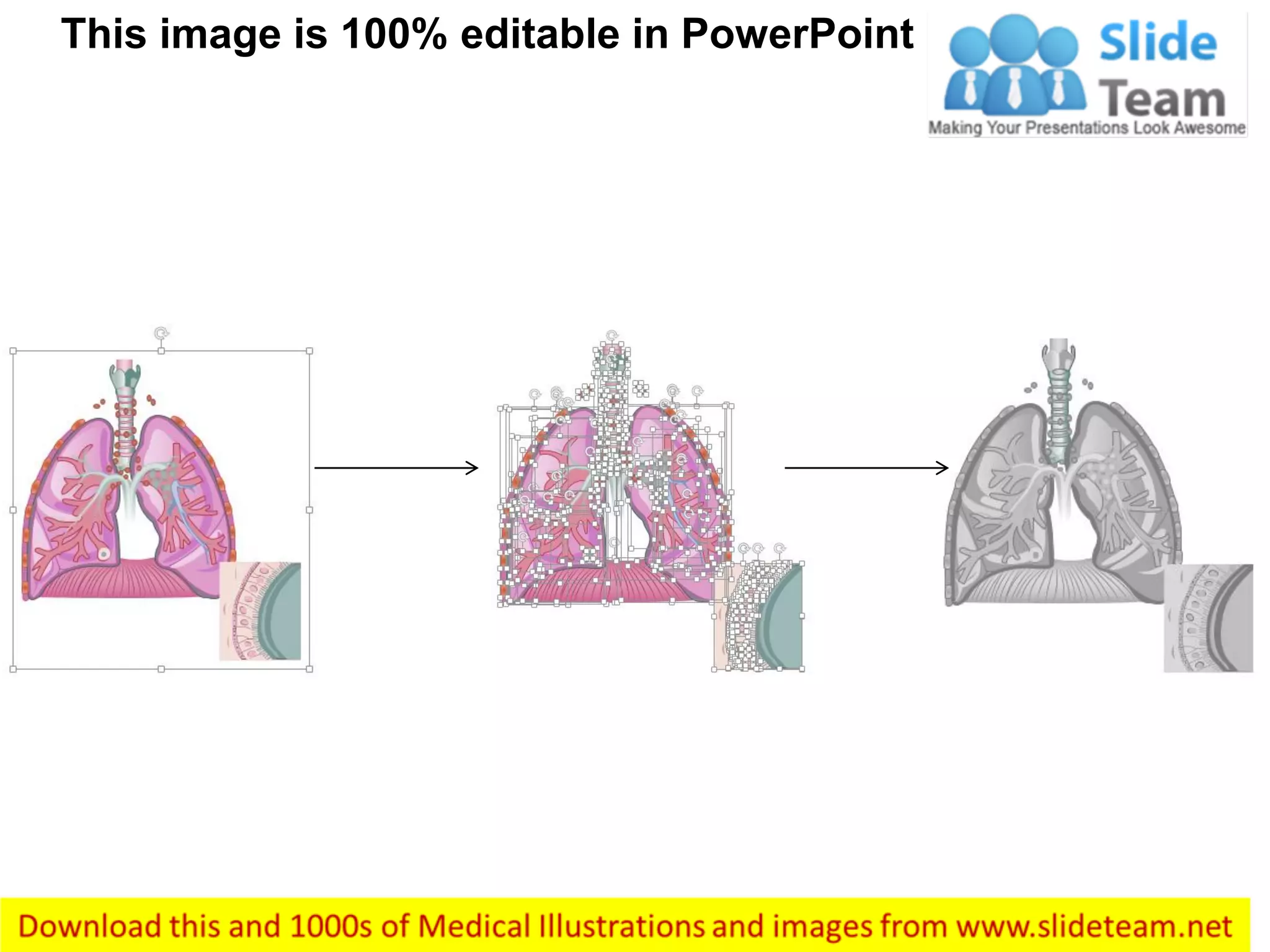 This image is 100% editable in PowerPoint
 