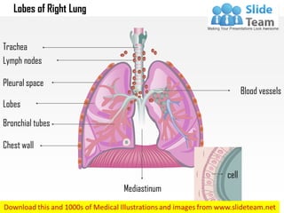 Lobes of Right Lung
Blood vessels
cell
Trachea
Lymph nodes
Pleural space
Lobes
Bronchial tubes
Chest wall
Mediastinum
 