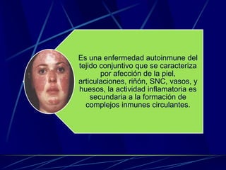 Es una enfermedad autoinmune del
tejido conjuntivo que se caracteriza
por afección de la piel,
articulaciones, riñón, SNC, vasos, y
huesos, la actividad inflamatoria es
secundaria a la formación de
complejos inmunes circulantes.
 