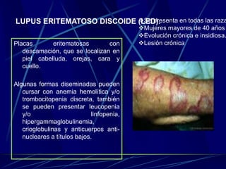 Placas eritematosas con
descamación, que se localizan en
piel cabelluda, orejas, cara y
cuello.
Algunas formas diseminadas pueden
cursar con anemia hemolítica y/o
trombocitopenia discreta, también
se pueden presentar leucopenia
y/o linfopenia,
hipergammaglobulinemia,
crioglobulinas y anticuerpos anti-
nucleares a títulos bajos.
Se presenta en todas las raza
Mujeres mayores de 40 años
Evolución crónica e insidiosa.
Lesión crónica
LUPUS ERITEMATOSO DISCOIDE (LED).
 