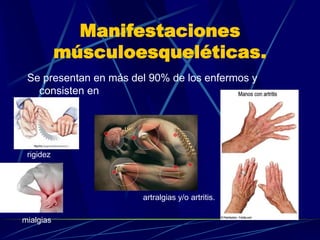 Manifestaciones
músculoesqueléticas.
Se presentan en más del 90% de los enfermos y
consisten en
rigidez
mialgias
artralgias y/o artritis.
 