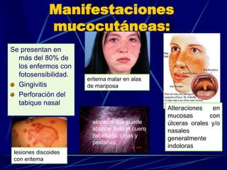 Manifestaciones
mucocutáneas:
Se presentan en
más del 80% de
los enfermos con
fotosensibilidad.
Gingivitis
Perforación del
tabique nasal
eritema malar en alas
de mariposa
lesiones discoides
con eritema
alopecia que puede
abarcar todo el cuero
cabelludo, cejas y
pestañas;
Alteraciones en
mucosas con
úlceras orales y/o
nasales
generalmente
indoloras
 