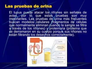 Las pruebas de orina
El lupus puede atacar los riñones sin señales de
aviso, por lo que estas pruebas son muy
importantes. Las pruebas de orina más frecuentes
buscan modelos celulares (fragmentos de células
que normalmente eliminan cuando la sangre se filtra
a través de los riñones) y proteinuria (proteína que
se derramaron en su cuerpo porque sus riñones no
están filtrando los desechos correctamente).
 