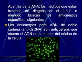 Además de la ANA, los médicos que están
tratando de diagnosticar el lupus a
menudo buscan los anticuerpos
específicos siguientes:
Los anticuerpos para ADN de doble
cadena (anti-dsDNA) son anticuerpos que
atacan el ADN en el interior del núcleo de
la célula.
 