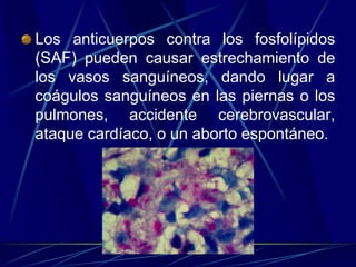 Los anticuerpos contra los fosfolípidos
(SAF) pueden causar estrechamiento de
los vasos sanguíneos, dando lugar a
coágulos sanguíneos en las piernas o los
pulmones, accidente cerebrovascular,
ataque cardíaco, o un aborto espontáneo.
 