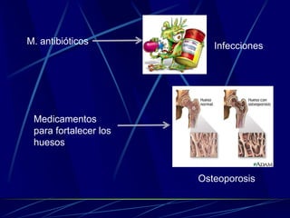 M. antibióticos Infecciones
Medicamentos
para fortalecer los
huesos
Osteoporosis
 