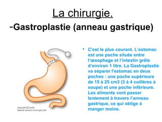 La chirurgie.
-Gastroplastie (anneau gastrique)
                ●
                    C'est le plus courant. L’estomac
                    est une poche située entre
                    l’œsophage et l’intestin grêle
                    d’environ 1 litre. La Gastroplastie
                    va séparer l'estomac en deux
                    poches : une poche supérieure
                    de 15 à 25 cm3 (3 à 4 cuillères à
                    soupe) et une poche inférieure.
                    Les aliments vont passer
                    lentement à travers l’anneau
                    gastrique, ce qui oblige à
                    manger moins.
 