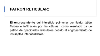 Rx LOBULILLO PULMONAR SECUNDARIO 1 (1).pptx