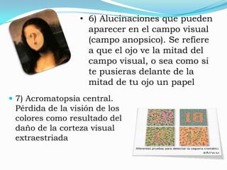 °°°FRANJA   VENTRAL°°°Es llamada la "Ruta qué", está asociada a la forma, reconocimiento y representación del objeto, relacionada con el almacenamiento de la Memoria de Largo Plazo.