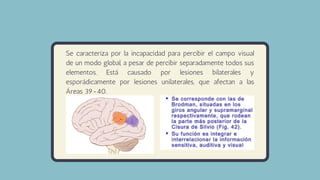 Se caracteriza por la incapacidad para percibir el campo visual
de un modo global, a pesar de percibir separadamente todos sus
elementos. Está causado por lesiones bilaterales y
esporádicamente por lesiones unilaterales, que afectan a las
Áreas 39-40.
 
