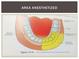AREA ANESTHETIZED
 