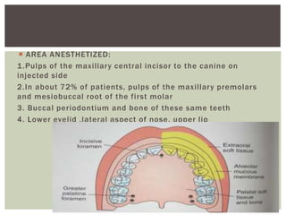  AREA ANESTHETIZED:
1.Pulps of the maxillary central incisor to the canine on
injected side
2.In about 72% of patients, pulps of the maxillary premolars
and mesiobuccal root of the first molar
3. Buccal periodontium and bone of these same teeth
4. Lower eyelid ,lateral aspect of nose, upper lip
 