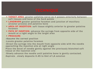  TARGET AREA: greater palatine nerve as it passes anteriorly between
soft tissues and bone of the hard palate
 LANDMARK:greater palatine foramen and junction of maxillary
alveolar process and palatine bone
 AREA OF INSERTION: soft tissue slightly anterior to greater palatine
foramen
 PATH OF INSRTION: advance the syringe from opposite side of the
mouth at a right angle to the target area
 PROCEURE
-Assume the correct position
-Locate greater palatine foramen
-Direct the syringe into the mouth from opposite side with the needle
approching the injection site at right angle
Place the bevel of needle gently against the previously blanched soft
tissue at the injection site
-Slowly advance the needle until palatine bone is gently contacted.
Aspirate , slowly deposite 0.45 to 6ml of LA solution
TECHNIQUE
 