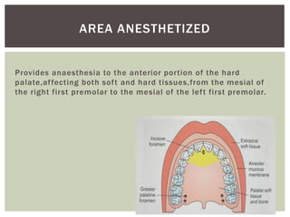 Provides anaesthesia to the anterior portion of the hard
palate,affecting both soft and hard tissues,from the mesial of
the right first premolar to the mesial of the left first premolar.
AREA ANESTHETIZED
 