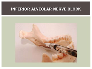 INFERIOR ALVEOLAR NERVE BLOCK
 