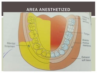AREA ANESTHETIZED
 