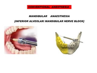 Local anaesthesia | PDF