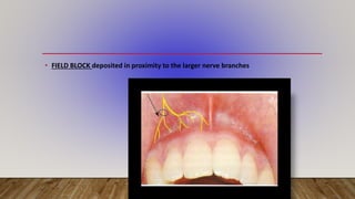 Local Anesthesia Field Block LOCAL ANAESTHESIA classification, contents , indication and ...