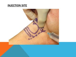 Local anaesthesia blocks in ent | PPTX