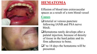 Extravascular Injection Local anaesthesia complications | PPTX
