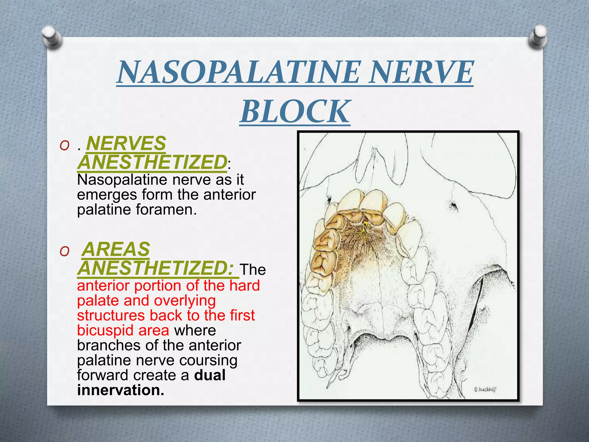 NASOPALATINE NERVE
BLOCK
O . NERVES
ANESTHETIZED:
Nasopalatine nerve as it
emerges form the anterior
palatine foramen.
O AREAS
ANESTHETIZED: The
anterior portion of the hard
palate and overlying
structures back to the first
bicuspid area where
branches of the anterior
palatine nerve coursing
forward create a dual
innervation.
 
