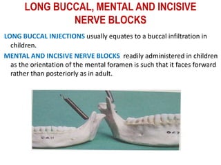 LONG BUCCAL, MENTAL AND INCISIVE
NERVE BLOCKS
LONG BUCCAL INJECTIONS usually equates to a buccal infiltration in
children.
MENTAL AND INCISIVE NERVE BLOCKS readily administered in children
as the orientation of the mental foramen is such that it faces forward
rather than posteriorly as in adult.
 
