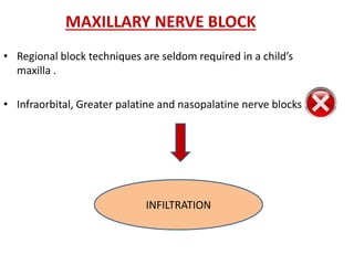 MAXILLARY NERVE BLOCK
• Regional block techniques are seldom required in a child’s
maxilla .
• Infraorbital, Greater palatine and nasopalatine nerve blocks
INFILTRATION
 