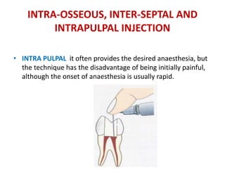 INTRA-OSSEOUS, INTER-SEPTAL AND
INTRAPULPAL INJECTION
• INTRA PULPAL it often provides the desired anaesthesia, but
the technique has the disadvantage of being initially painful,
although the onset of anaesthesia is usually rapid.
 