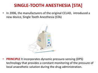 SINGLE-TOOTH ANESTHESIA [STA]
• In 2006, the manufacturers of the original CCLAD, introduced a
new device, Single Tooth Anesthesia (STA)
• PRINCIPLE It incorporates dynamic pressure-sensing (DPS)
technology that provides a constant monitoring of the pressure of
local anaesthetic solution during the drug administration.
 
