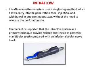 • IntraFlow anesthesia system uses a single-step method which
allows entry into the penetration zone, injection, and
withdrawal in one continuous step, without the need to
relocate the perforation site.
• Reemers et al. reported that the IntraFlow system as a
primary technique provide reliable anesthesia of posterior
mandibular teeth compared with an inferior alveolar nerve
block.
INTRAFLOW
 