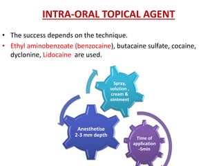 INTRA-ORAL TOPICAL AGENT
• The success depends on the technique.
• Ethyl aminobenzoate (benzocaine), butacaine sulfate, cocaine,
dyclonine, Lidocaine are used.
Time of
application
-5min
Anesthetise
2-3 mm depth
Spray,
solution ,
cream &
ointment
 