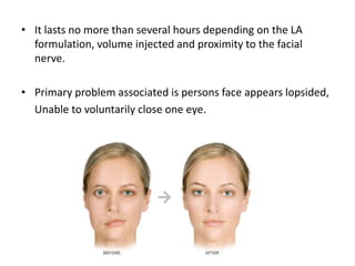• It lasts no more than several hours depending on the LA
formulation, volume injected and proximity to the facial
nerve.
• Primary problem associated is persons face appears lopsided,
Unable to voluntarily close one eye.
 