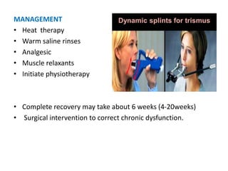 MANAGEMENT
• Heat therapy
• Warm saline rinses
• Analgesic
• Muscle relaxants
• Initiate physiotherapy
• Complete recovery may take about 6 weeks (4-20weeks)
• Surgical intervention to correct chronic dysfunction.
 