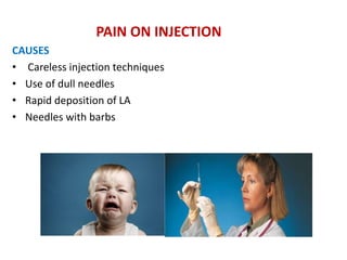 PAIN ON INJECTION
CAUSES
• Careless injection techniques
• Use of dull needles
• Rapid deposition of LA
• Needles with barbs
 