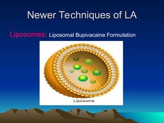 Newer Techniques of LA
Newer Techniques of LA
Liposomes: Liposomal Bupivacaine Formulation
 