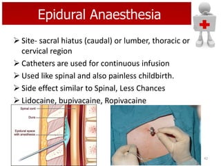Epidural Anaesthesia
 Site- sacral hiatus (caudal) or lumber, thoracic or
cervical region
 Catheters are used for continuous infusion
 Used like spinal and also painless childbirth.
 Side effect similar to Spinal, Less Chances
 Lidocaine, bupivacaine, Ropivacaine

42

 
