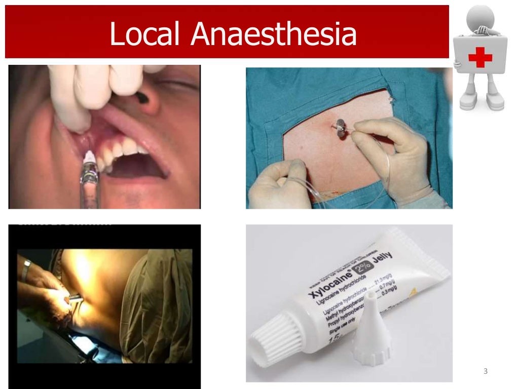 Local anaesthetics