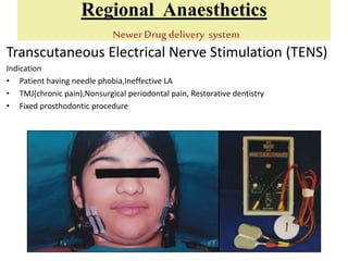 Regional Anaesthetics
NewerDrug delivery system
Transcutaneous Electrical Nerve Stimulation (TENS)
Indication
• Patient having needle phobia,Ineffective LA
• TMJ(chronic pain),Nonsurgical periodontal pain, Restorative dentistry
• Fixed prosthodontic procedure
 