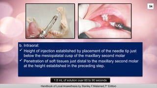 Mid Palatal Injection LOCAL ANAESTHETIC TECHNIQUES (1).pptx for dentist | PPTX