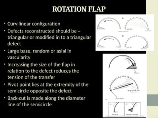 Triangular Flao LOCAL AND REGIONAL FLAPS IN ORAL SURGERY.pptx