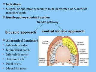 1 /1031 /103
 Indications
• Surgical or operative procedure to be performed on 5 anterior
maxillary teeth.
 Needle pathway during insertion
Needle pathway
central incisor approach
 Anatomical landmark
• Infraorbital ridge
• Supraorbital notch
• Infraorbital notch
• Anterior teeth
• Pupil of eye
• Mental foramen
Bicuspid approach
 